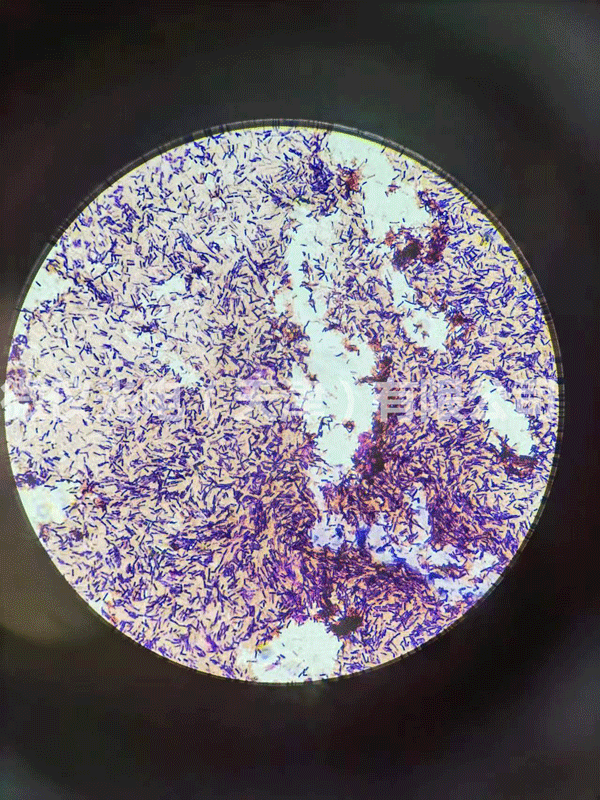 用石榴视频在线观看光電石榴视频黄下载進行芽孢及革蘭氏染色杆菌的觀察